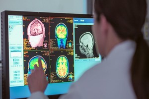 How Radiation Planning Works with DICOM Images - Presented by PostDICOM